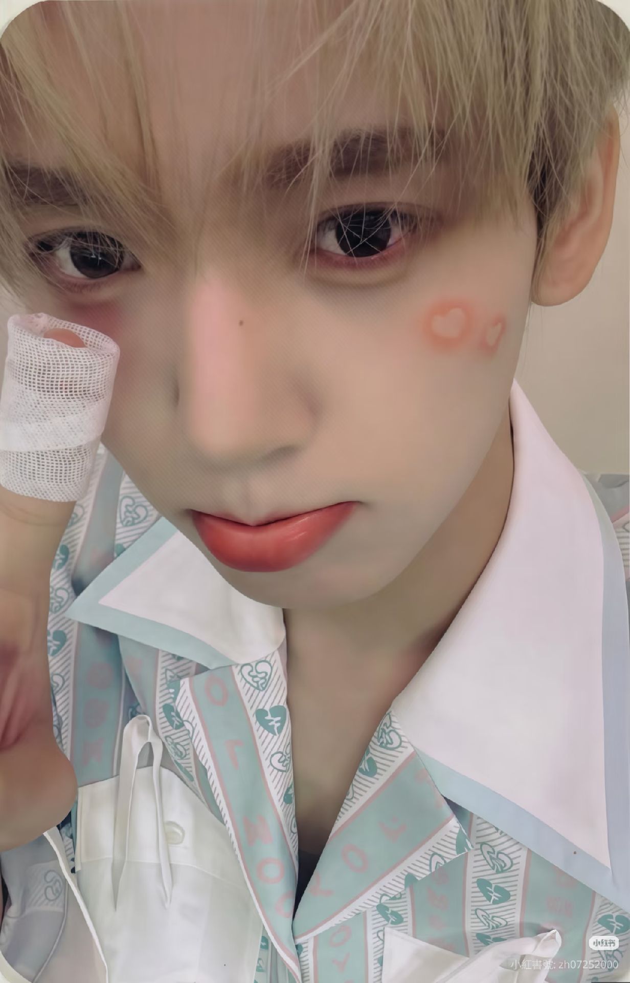 手指繃帶辰（非現）