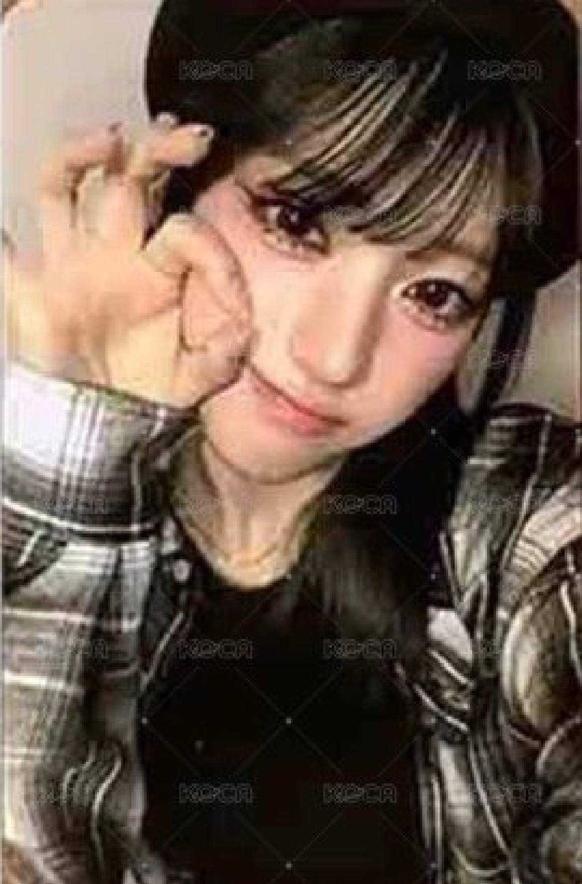 slm臉頰丸子 俊輝