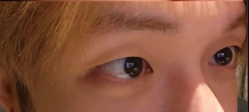 해파리