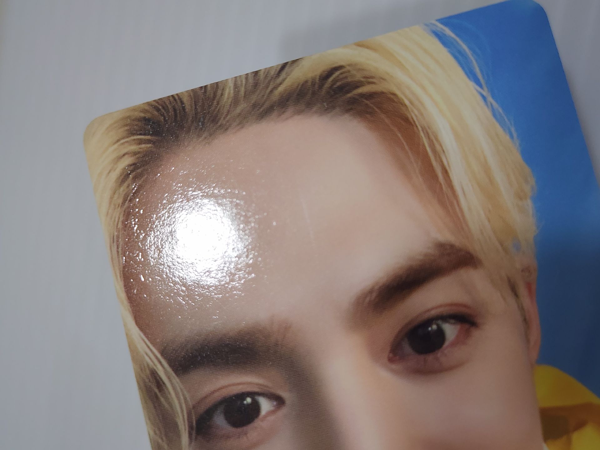 左3很淺的損從髮際線到鼻子中間